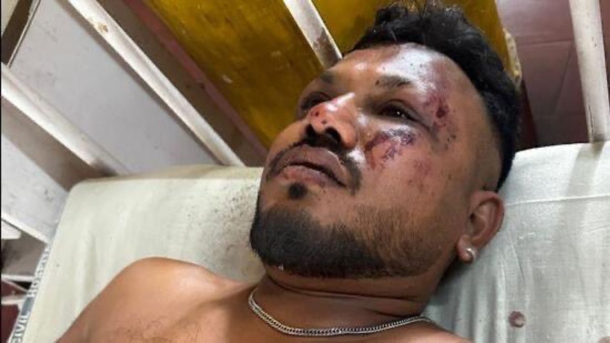 VIDEO - Milagroso registro: sobreviviente del accidente aéreo en India salió caminando