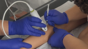 Cómo funciona la terapia de bótox del Hospital Roberto del Río para estimular a niños con parálisis cerebral
