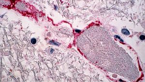 Todo lo que se sabe del virus Nipah: qué es, cuáles son sus síntomas y cómo se contagia