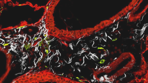 Científico chileno lidera estudio internacional que reduce el daño pulmonar en infecciones severas