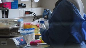 Autoridades descartaron ébola: qué se sabe de la muerte del vietnamita que fue internado en Chile por fiebre hemorrágica