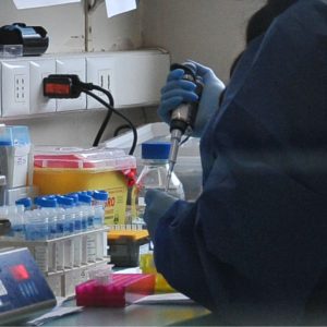 Autoridades descartaron ébola: qué se sabe de la muerte del vietnamita que fue internado en Chile por fiebre hemorrágica
