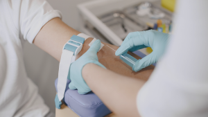 Inteligencia artificial detecta patrones de tumores en la sangre sin necesidad de biopsia