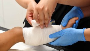 ¿Qué hacer ante una quemadura? COANIQUEM entrega recomendaciones y orientación gratuita las 24 horas