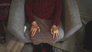 Chilenas son las más afectadas: capacidad de detectar riesgo de Alzheimer avanza más rápido que su tratamiento
