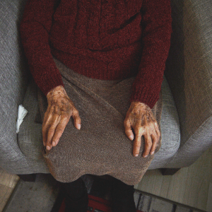 Chilenas son las más afectadas: capacidad de detectar riesgo de Alzheimer avanza más rápido que su tratamiento